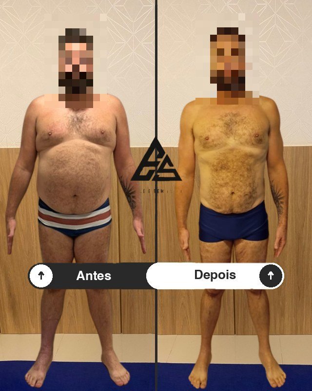 Antes e depois