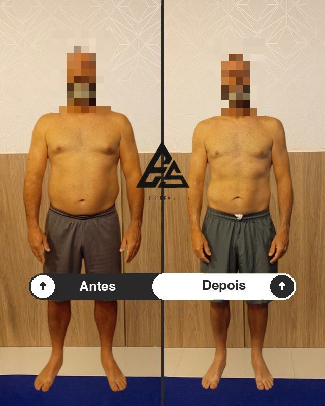 Antes e depois
