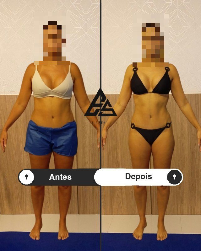 Antes e depois