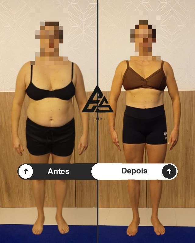 Antes e depois