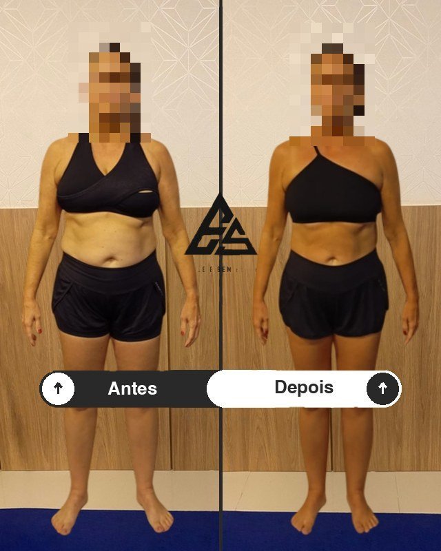 Antes e depois