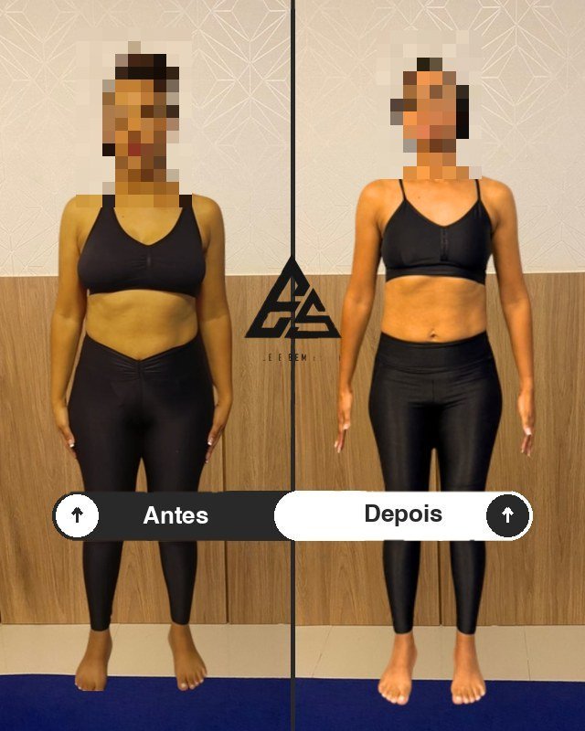 Antes e depois