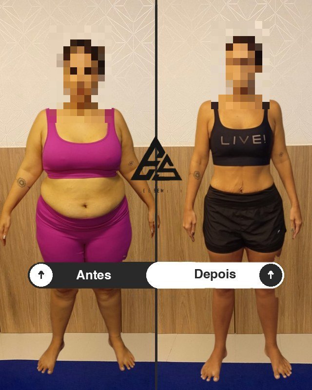 Antes e depois