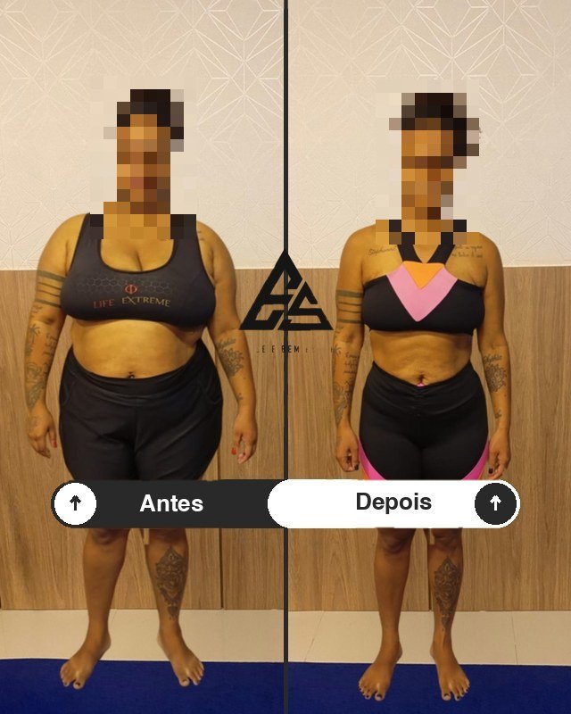 Antes e depois