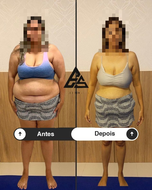Antes e depois