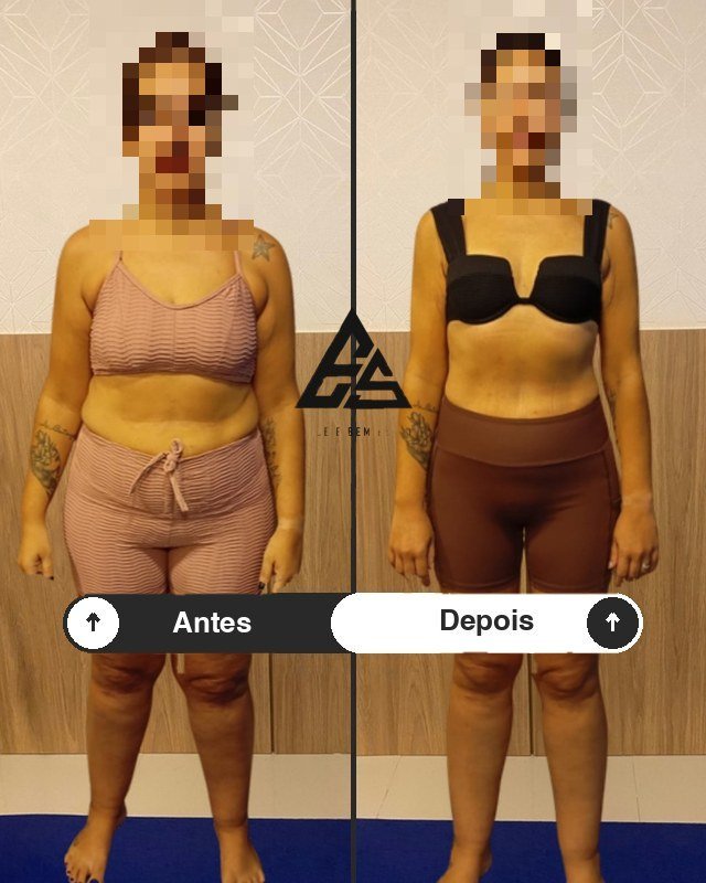 Antes e depois