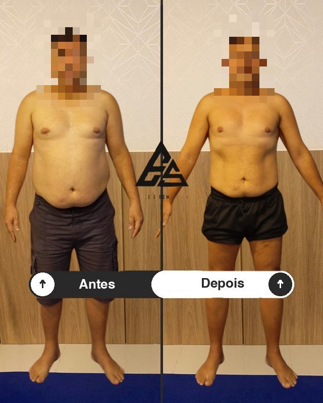 Antes e depois