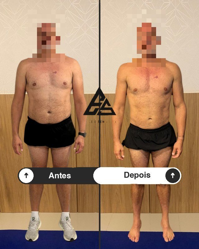 Antes e depois