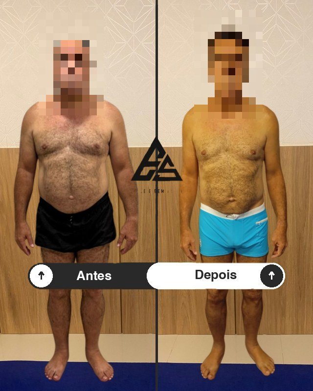 Antes e depois